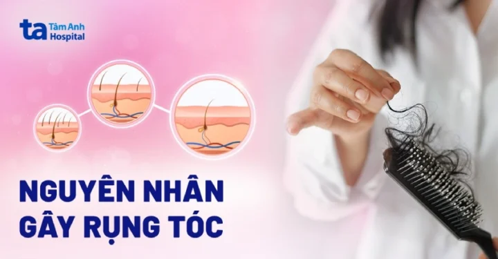 Lý Do Tóc Rụng Nhiều: Nguyên Nhân Sâu Xa & Giải Pháp Toàn Diện 2026 Hình ảnh minh họa các loại thực phẩm tốt cho tóc