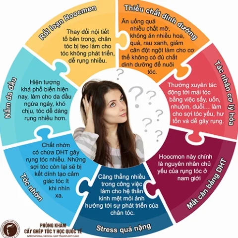 Lý Do Tóc Rụng Nhiều: Nguyên Nhân Sâu Xa & Giải Pháp Toàn Diện 2026 Infographic về các nguyên nhân gây rụng tóc