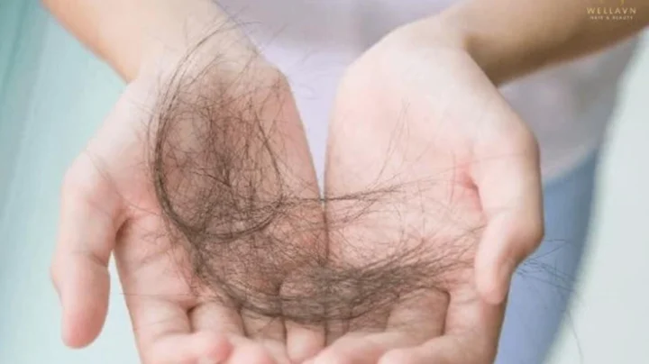 Mơ thấy người khác bị rụng tóc